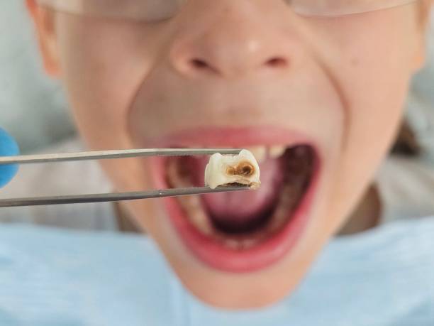 Best Same-Day Emergency Dentist in Springfield, GA