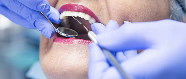 Best Emergency Tooth Extraction in Springfield, GA